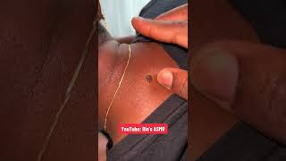 Asmr Skin Tag Play And Gum Chewing To Make You Relax
