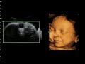 ultrasound 3d 4d