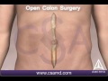 Colo Rectal