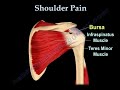 shoulder
