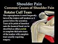 shoulder