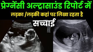 कय परगनस अलटरसउड रपरट म लडक लडक लख रहत ह?