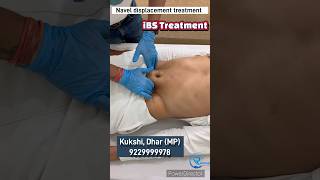 Ibs Treatment.