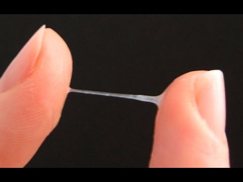 womb most cancers tiredness symptoms of terminal cervical cancer