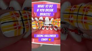 What To Do If You Break Braces Eating Halloween Candy