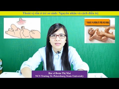 Hướng Dẫn Nhận Biết Thoát Vị Rốn ở Trẻ | Bác sĩ Đoàn Thị Mai
