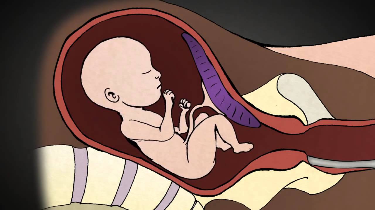 2019 year - What Is an Abortion 2019 year