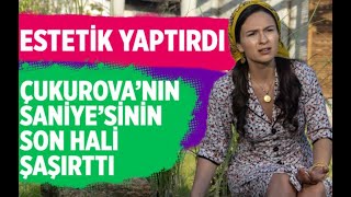 Atv Bir Zamanlar Ova Yıldızı Selin Yeninci Burun Estetiği Yaptırdı Yorum Yağdı