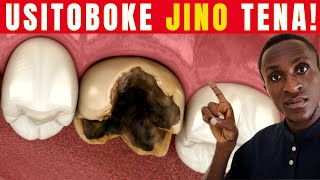 Jinsi Ya Kuepuka Kutoboka Meno Dr Maarifa
