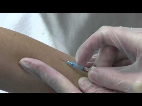 Insertion and management of nasogastric tubes for adults