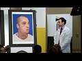 The world's most extensive face transplant: Richard Norris, University of Maryland
