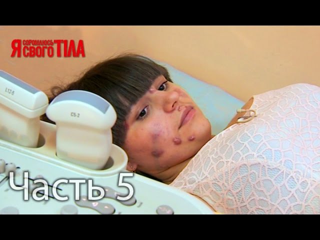 Я стесняюсь своего тела девушка с рукой монстра что с ней стало Я стесняюсь своего тела девушка с рукой монстра что с ней стало
