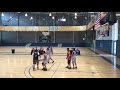 HAND AMPUTEE AND LEG AMPUTEE IN BASKETBALL GAME