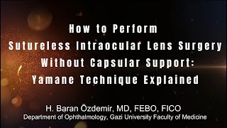 How To Perform Sutureless Intraocular Lens Surgery Without Capsular Support Yamane Technique