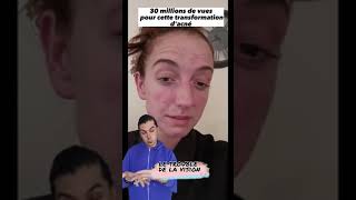 Transformation Dacné Incroyable