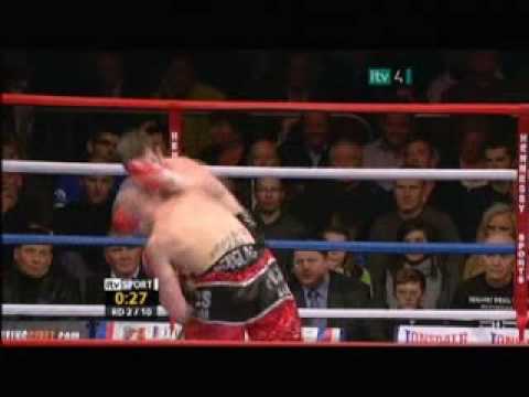 Lee Purdy v Mark Douglas