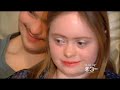 Down's syndrome