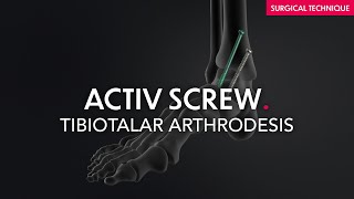 Surgical Technique - Activ Screw - Tibiotalar Arthrodesis