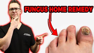 Tea Tree Oil Toenail Fungus Home Treatment Doctor Cure