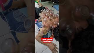 Cạo Gió Giác Hơi Trị Liệu Tại Nhà Tphcm - Cupping Therapy Ho Chi Minh Vietnam - Mage