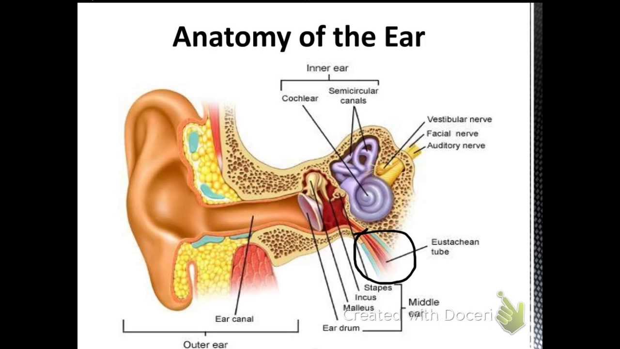 Mastoiditis - YouTube