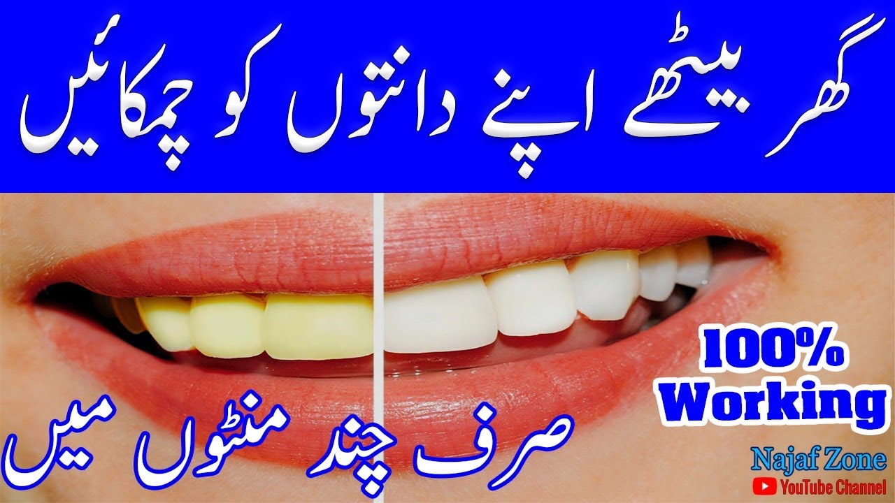 11 Easy Ways To Whiten Your Teeth At Home 11 Easy Ways To Whiten Your Teeth At Home new images 11 Easy Ways To Whiten Your Teeth At Home 11 Easy Ways To Whiten Your Teeth At Home new picture