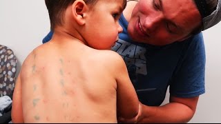 Whats Wrong With His Skin?