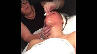 LIVE Microdermabrasion Treatment - Skin Care Makeup Center - Stamford, CT