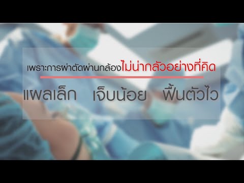 แชร์ประสบการณ์ การผ่าตัดผ่านกล้องรักษาไส้เลื่อน – โรงพยาบาลมหาชัย 2