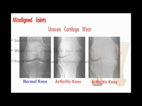 Brandon Biebel teaches Joint Mechanics