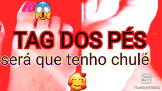 Tag Dos Pésserá Que Tenho Chulé