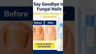 Say Goodbye To Fungal Nails Scholls Fast-Acting 2-In-1 Treatment