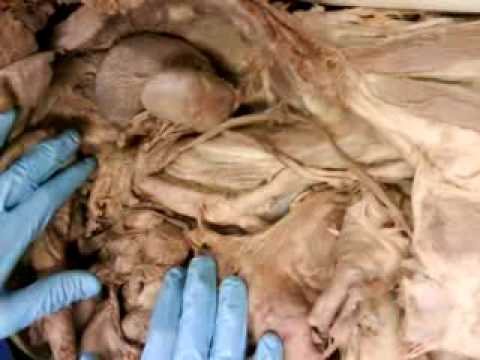 Cadaver Arteries & Veins 1 - YouTube