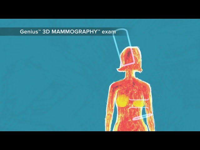 Watch Genius™ 3D mammogram on YouTube.