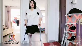The beautiful woman suffering from polio bravely challenges disability and walks on crutches #polio