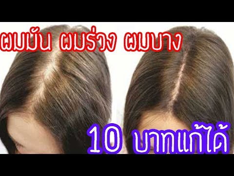 แชร์เก็บไว้สูตร รักษา ผมมัน ผมร่วง ผมบาง หลัก10บาทง่ายๆๆได้ตัวเองที่บ้านเห็นผลภายใน7วันต้องลอง