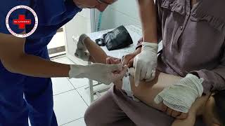 Intramuscular Injection For Baby. Ock Injection