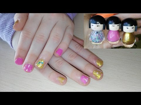 Какие они - арабские мужчины? (опыт отношений с) Как удаляют корень зуба? будут резать десну? мне плохо!