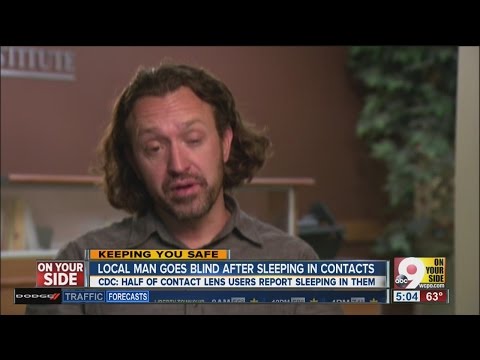 Cincinnati man goes blind in one eye after sleeping in contacts