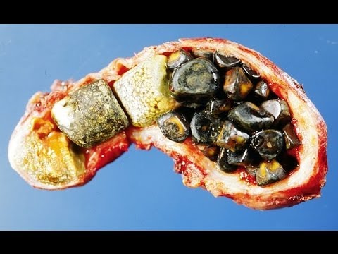 Discussion on this topic: Betrixaban Reviews, betrixaban-reviews/ Communication on this topic: Betrixaban Reviews, betrixaban-reviews/