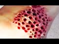 Largest Blackheads Presents Real or Fake; Trypophobia Cyst Arm