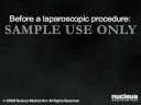 Gallbladder Surgery for Gallstones