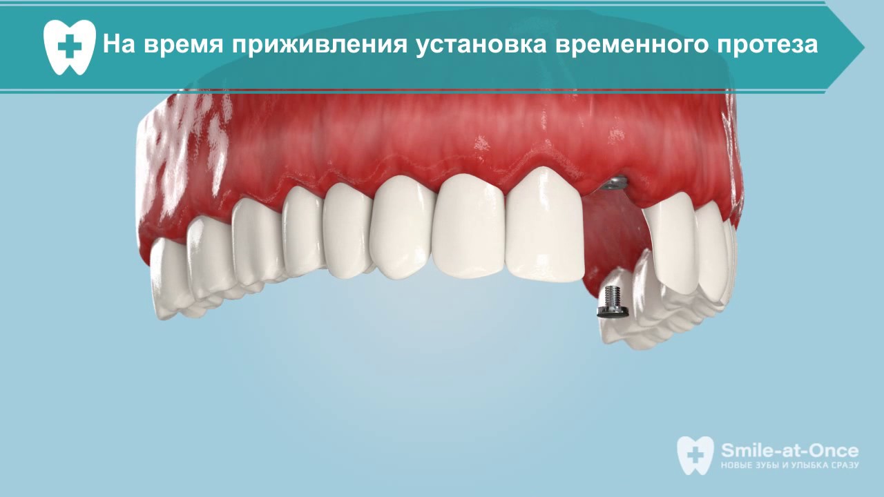 Модные стрижки волос для женщин. Короткие, длинные и Модные выбритые виски у женщин 2017 образы 84 фото Женская мода