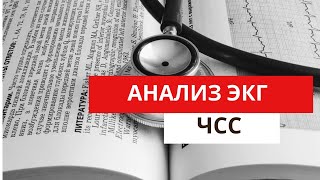 Анализ Экг. Определение Чсс (Частоты Сердечных Сокращений).