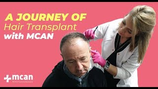 Hair Transplant In Turkey With Mcan Health