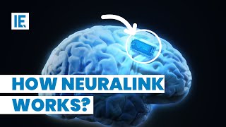 Video: How Elon Musk's Neuralink works