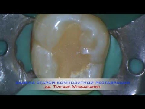 Prof Hair - Профессиональная косметика для волос Cтраница 101: Ботокс в лоб и в губы. / Цены и отзывы на инъекции Ботокса