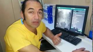 Düsg Di̇rek Uruner Si̇stem Grafisi Anatomi Ve Cekim Sekli