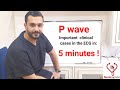 As simple as this ! Mastering P wave clinical cases in the ECG in 5 minutes!