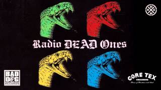 Watch Radio Dead Ones We Got So Much More video